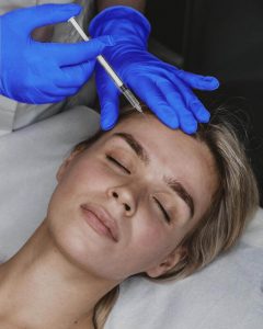 Applicazione botox su fronte